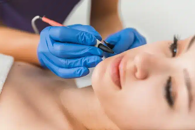 an electrolysis working on a client